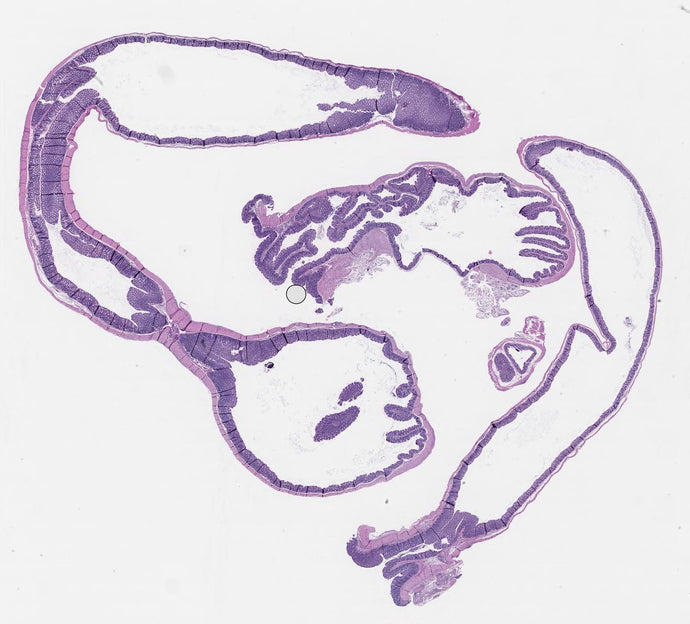 colon GB012_87_O 2015-12-05